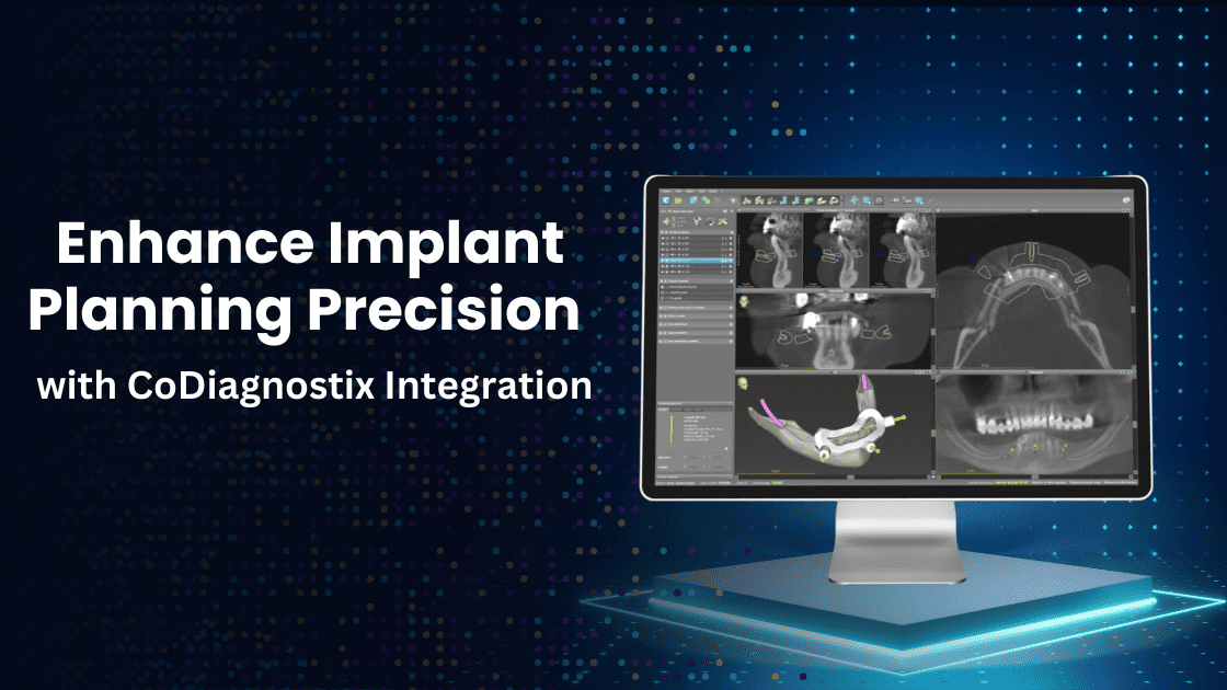 Enhance Implant Planning Precision with CoDiagnostix Integration