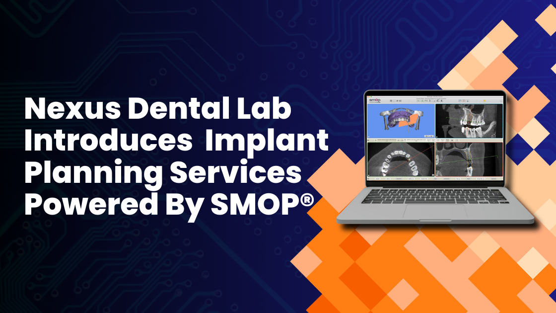 Nexus DNexus Dental Lab Introduces Implant Planning Services Powered By SMOP®ental Lab Introduces SMOP® Implant Planning Services