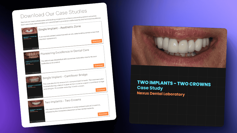 Nexus Dental case studies with implant examples.