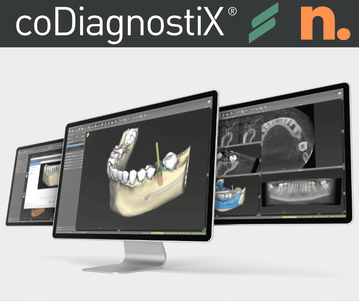 Dental imaging software displayed on computer screens.
