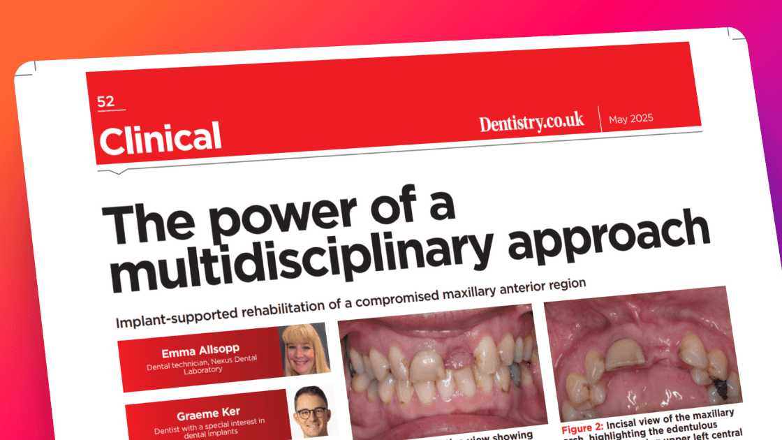 Dental article: Multidisciplinary approach to maxillary rehabilitation.