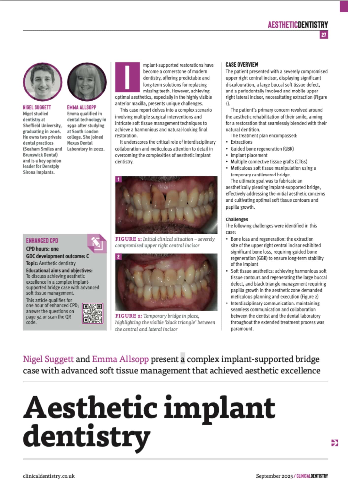 Aesthetic implant dentistry overview with case details.